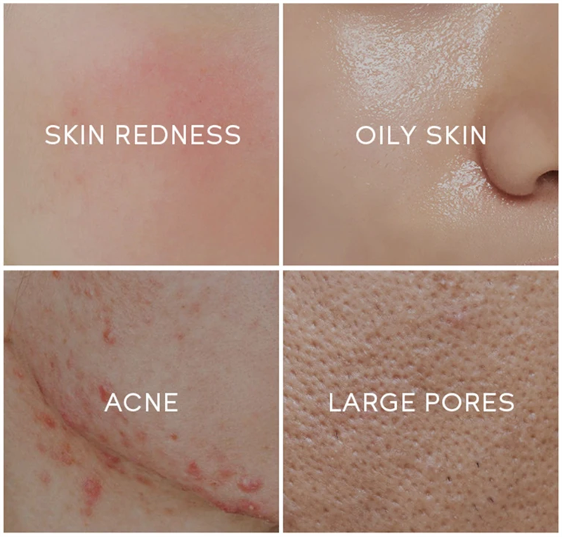 Professional Private Label Professional Hyaluronic Acid Serum De Aging Acne Stem Cell Ampoule Serum