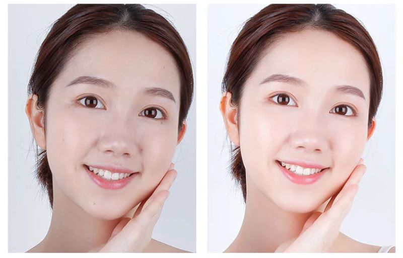 Professional Private Label Professional Hyaluronic Acid Serum De Aging Acne Stem Cell Ampoule Serum