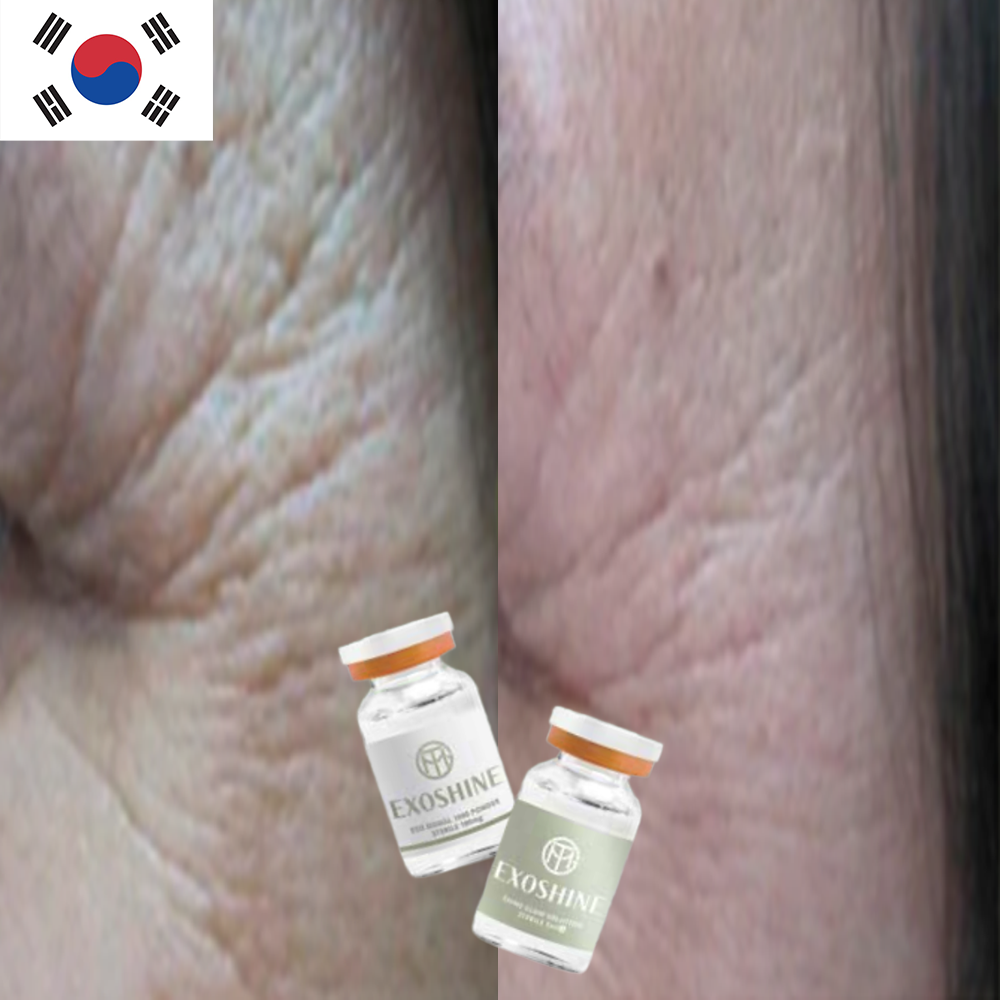 Shine Solution Signal 1000 Liquid Collagen Peptides Whitening Serum Skin Booster Hydrating Care 5 Vials