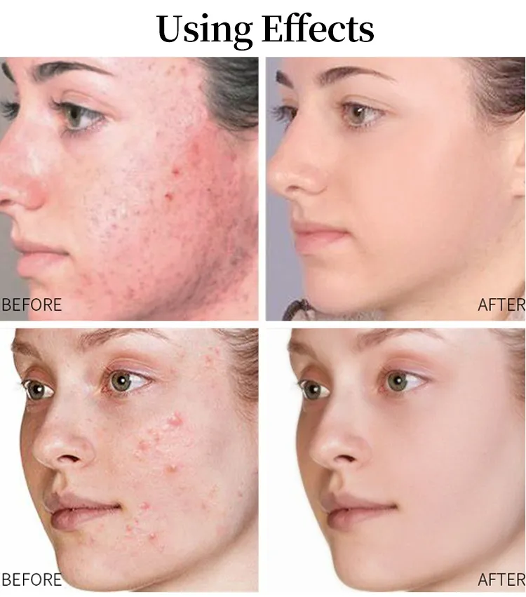 OEM Hyaluronic Acid Collagen Moisturizing Hydrating Smoothing Retinol Snail Arbutin Vitaming C Serum
