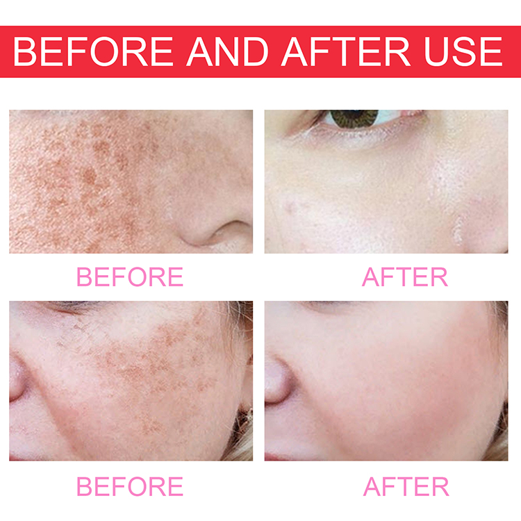 Private Label Natural Moisturizing Whitening Shrink Pores Serum 10% Niacinamide + Zinc Oil Control Face Serum
