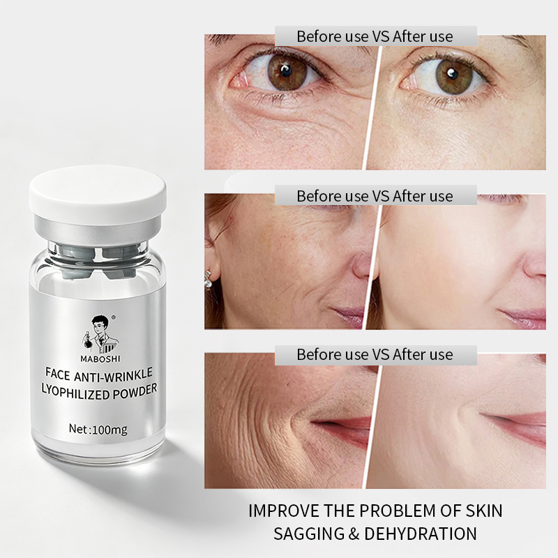 New Exosom Lyophilized Essence Repair Skin Barrier Retinol Niacinamide Even Skin Tone Collagen Brightening Anti-wrinkle Serum