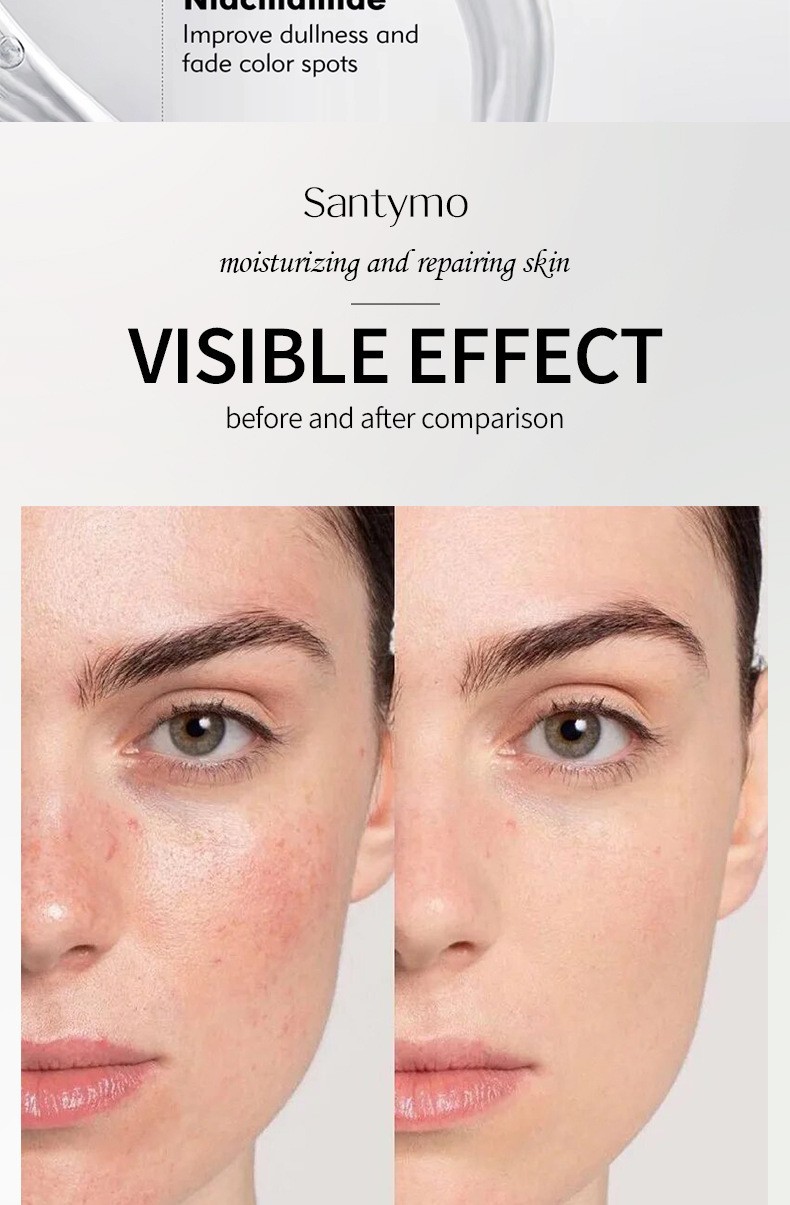 Vitamin C Serum in Stock, Improves Dullness, Hydrates, Brightens, and Provides Antioxidant Benefits.