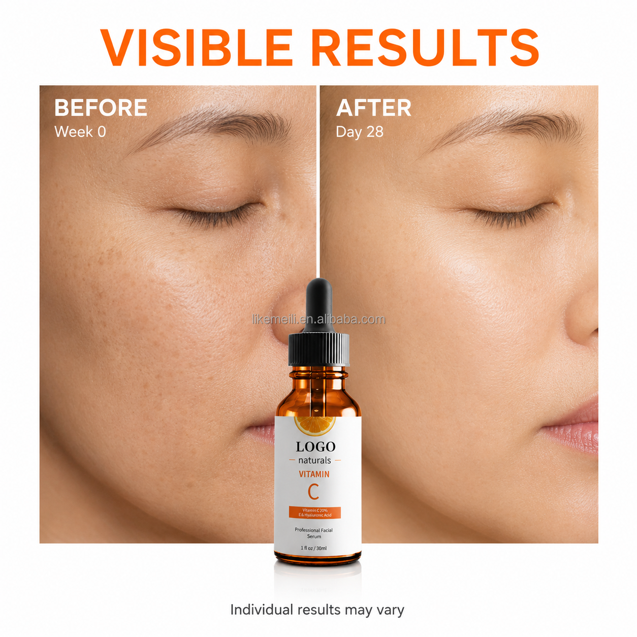 Private Label Natural Anti Aging Whitening Dark Spot Nourishing Moisturizing Custom Logo Korean Skin Care Face Vitamin C Serum