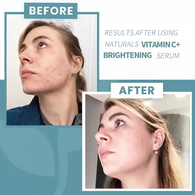 Wholesale Private Label Vegan Vitamin C Serum Anti-Aging Anti-Wrinkle Custom LOGO Rejuvenating Whitening Face Skin Cruelty Free