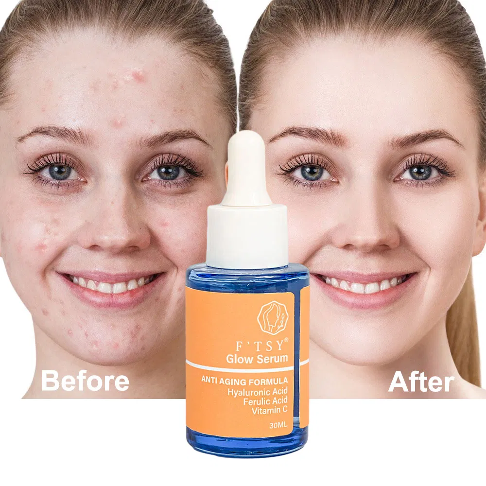 OEM/ODM Whitening Anti Aging Ferulic Acid Glow Serum Hydrating Essence for Face