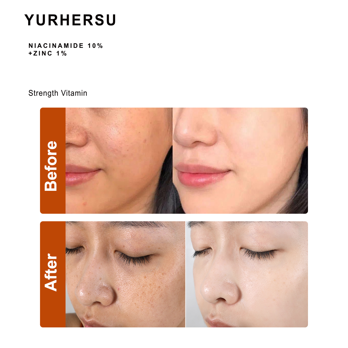 10% Niacinamide 1% Zinc PCA Serum High Concentration Vitamin B3 Facial Essence for Effective Fade Pore Minimizer Refining