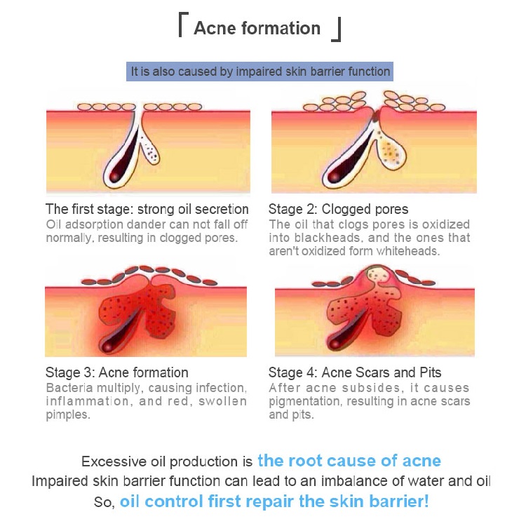 Private Label Barrier Repair Skin Care Cream Adult Recombinant Humanized Type III Collagen Repairing Face Cream For Acne Scar