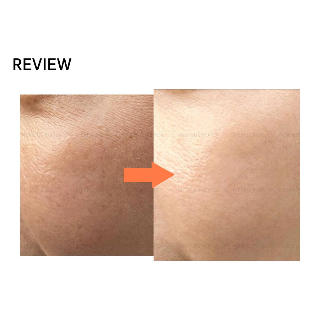 PDRN Brightening Facial Serum Skin Repair Moisturizing Anti-Aging Ampoule for Glowing Skin OEM private label korean