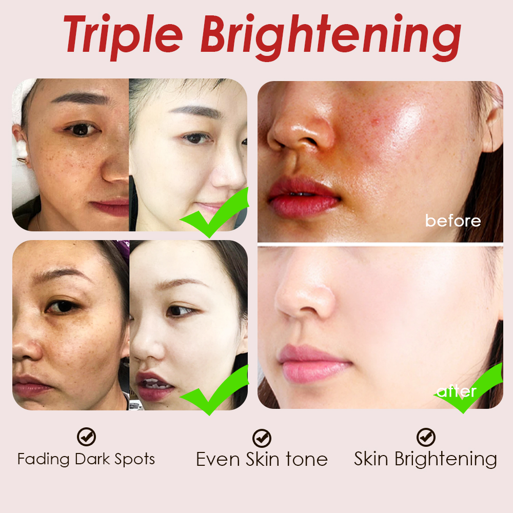 Triple Action Brightening Serum 10% Niacinamide 4% Tranexamic Acid Arbutin Dark Spot Whitening Niacinamide Face Serum