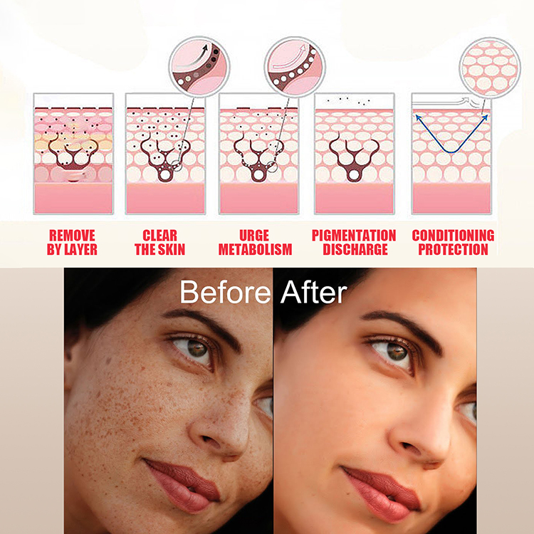 Private Label Natural Moisturizing Whitening Shrink Pores Serum 10% Niacinamide + Zinc Oil Control Face Serum