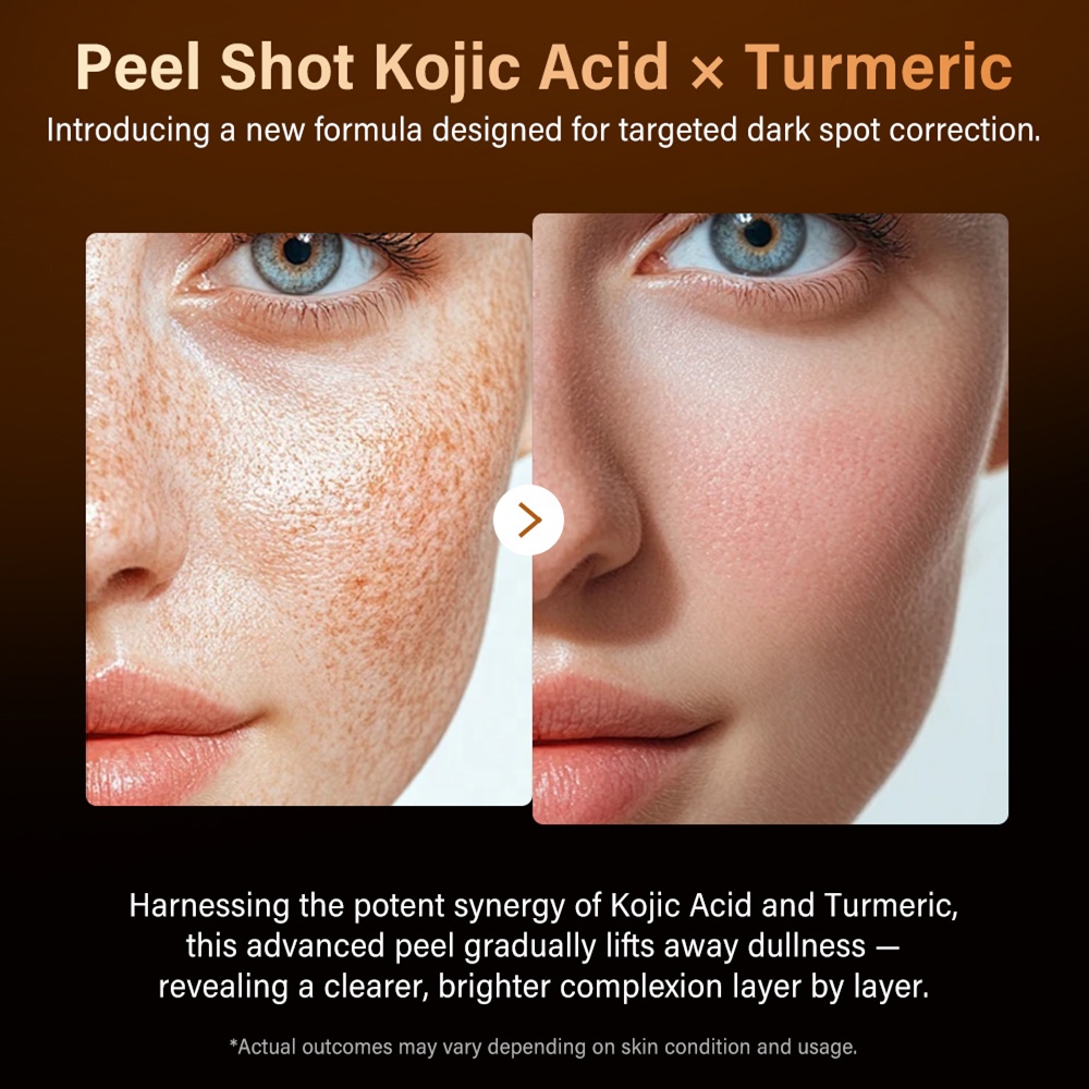 Kojic Acid Turmeric Peel Shot Serum 80ml Korean Exfoliating Facial Serum for Dark Spot Care Gently Removes Dead Skin Brightens