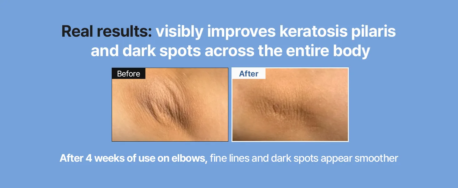 Retinal Skin Booster Serum Feature 4