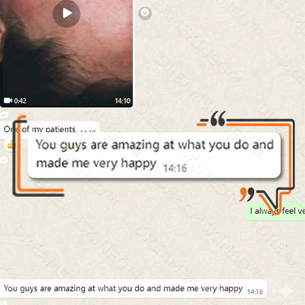 Customer success 4