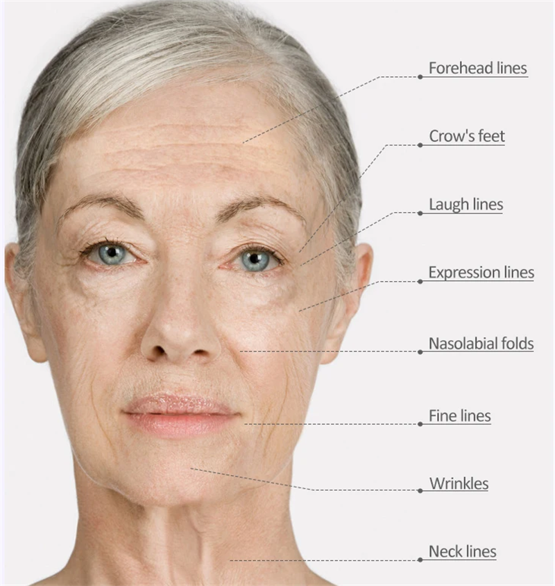 Professional Private Label Professional Hyaluronic Acid Serum De Aging Acne Stem Cell Ampoule Serum