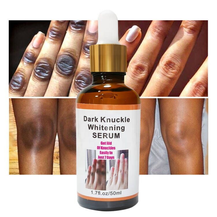 Private Label Organic Moisturizing Brightening 7 Days Dark Knuckle Eraser Oil Remover Whitening Serum