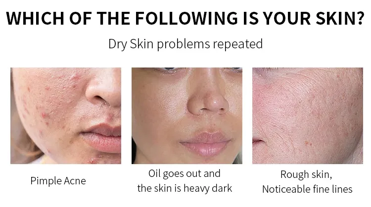 Exfoliating Face Serum Shrink Pores Skin Care Products Hydrating Face Glowing Serum