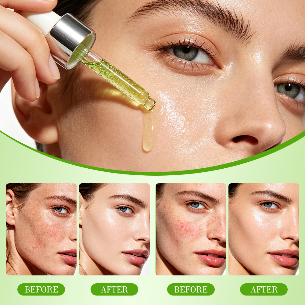 IREV Aloe Vera &amp; Pdrn Calming Serum for Nose &amp; Face-Whitening Nourishing Firming Moisturizer with Redness Relief &amp; Brightening