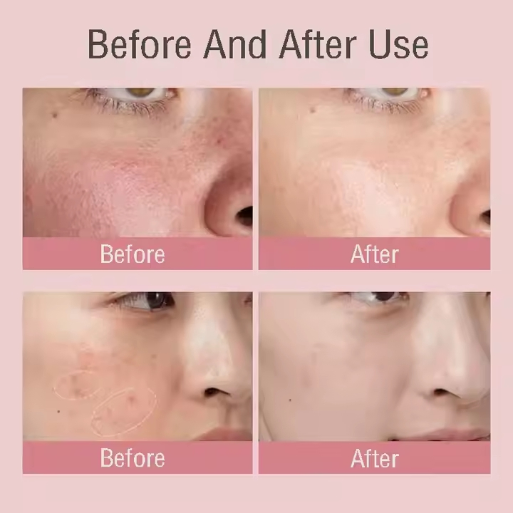J OEM ODM Pdrn Pink Peptide Serum Pink Glow Serum Peptide Niacinamide Hydrating Moisturizing Firming Even Skin Tone Serum