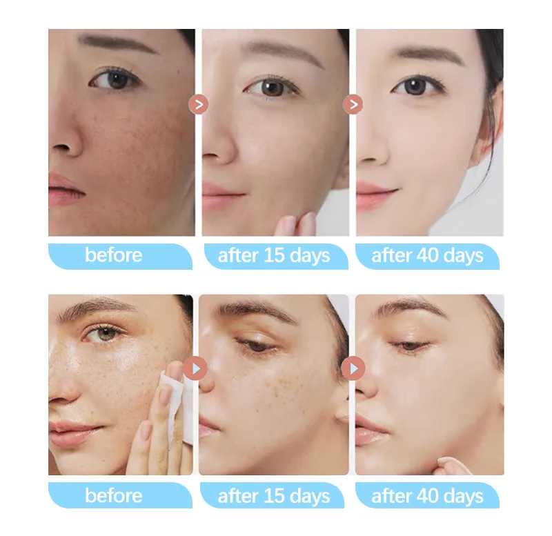 Kojic Acid Serum Image 8
