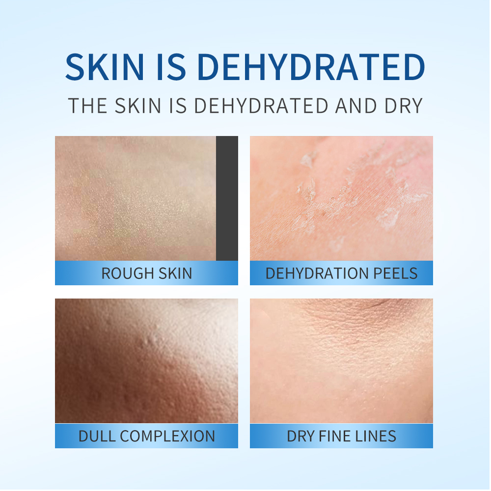 Hyaluronic Acid Serum 30ml Deep Hydration Moisturizing Anti-Dullness Face Serum OEM Private Label