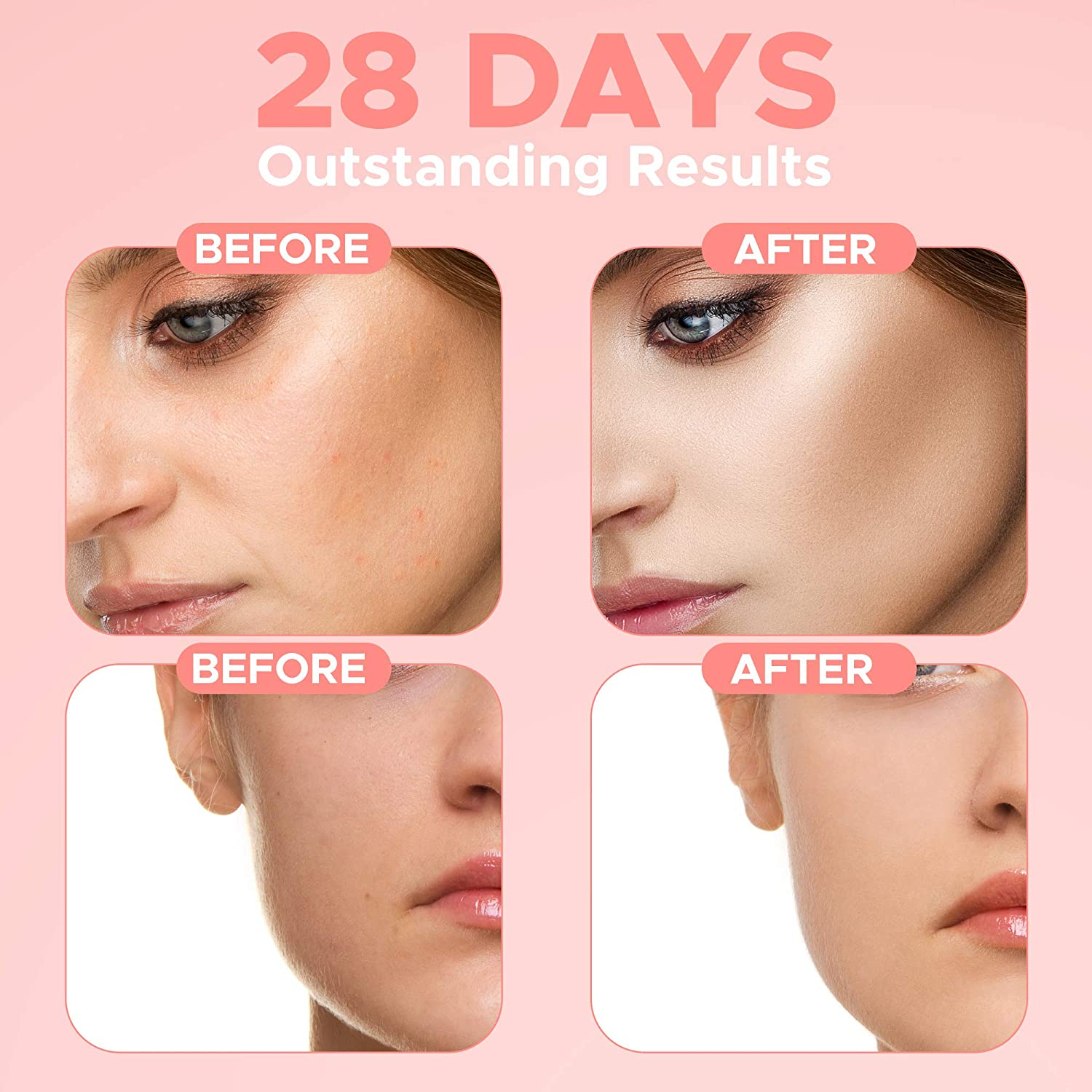 Private Label Anti-dark Spots Facial Whitening Hyaluronic Acid Niacinamide Vitamin E Vitamin C Skin Care 4 in 1 Face Serum