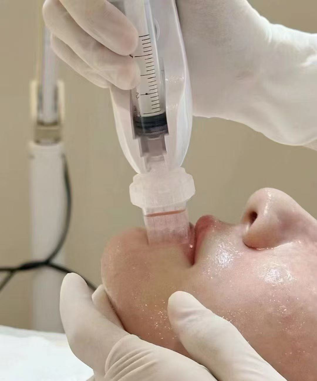 Hyaluronic Acid Feature 2