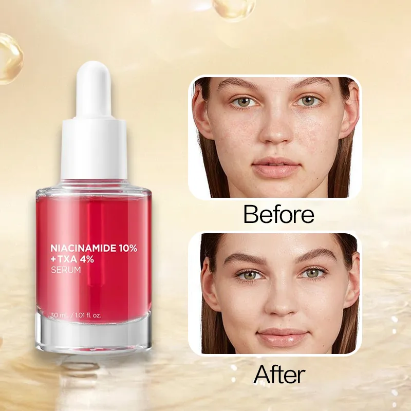 Private Label 10% Niacinamide & Tranexamic Acid Serum for Sensitive Skin