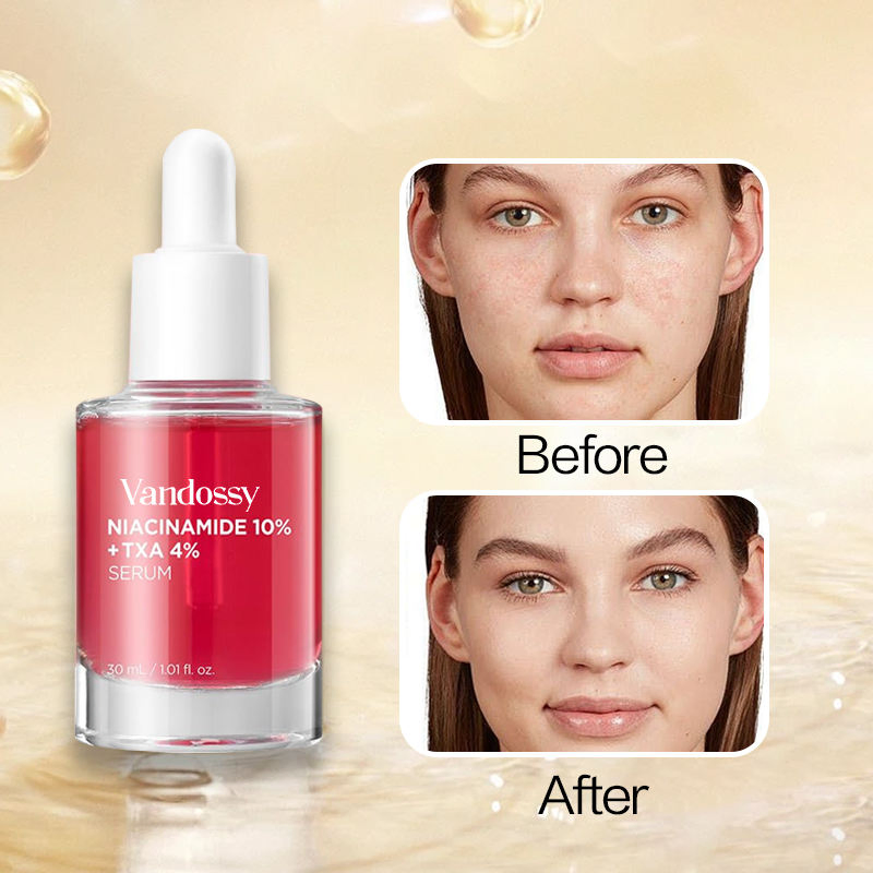 Private Label 10% Niacinamide &amp; Tranexamic Acid Serum for Sensitive Skin