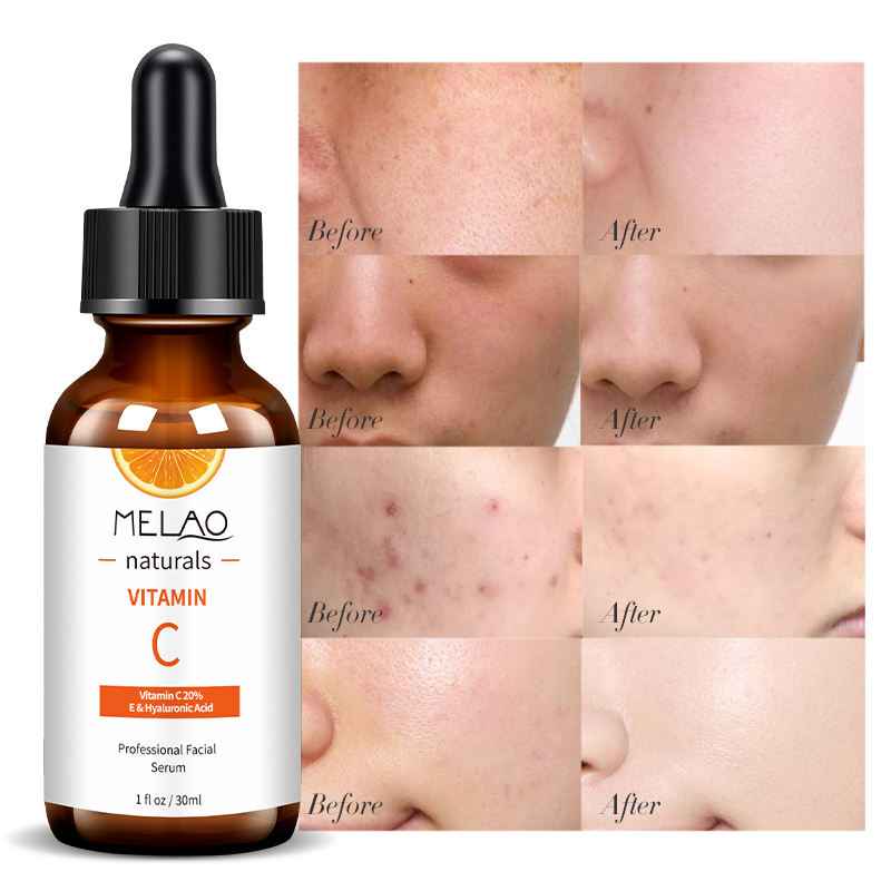 Melao Beauty Hyaluronic Acid Anti Aging Whitening Face Care Cosmetic Korean Skin Care Products Peptides Vitamin c Serum for Face