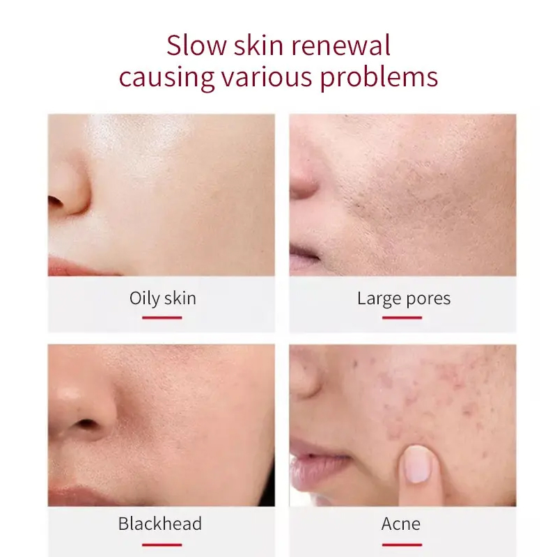 Ditong OEM Factory Sales Face Care Cosmetic Hyaluronic Acid Moisturizing Hydrating Serum