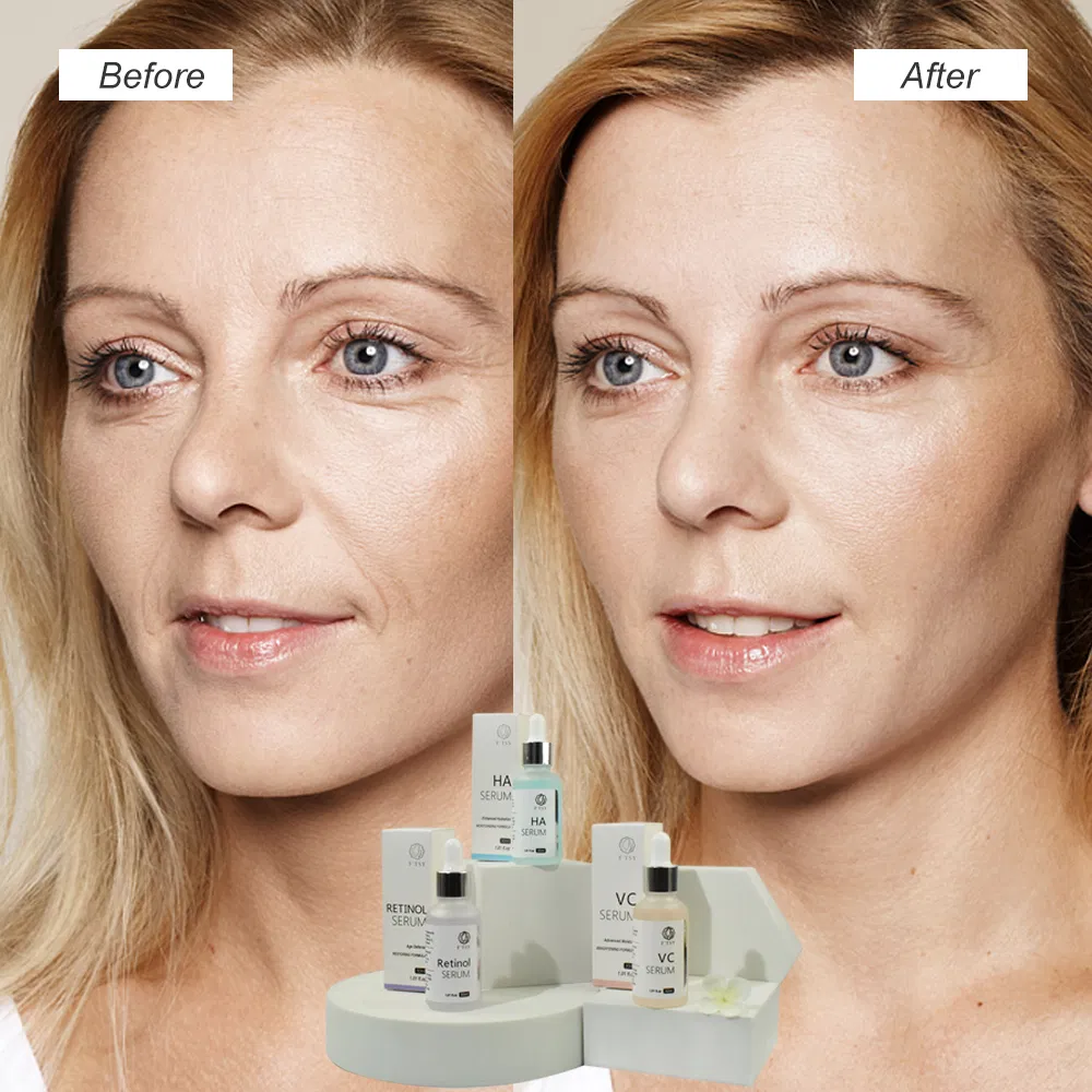 Hot Selling Whitening Vitamin C Serum Ha Hydrating Face Serum