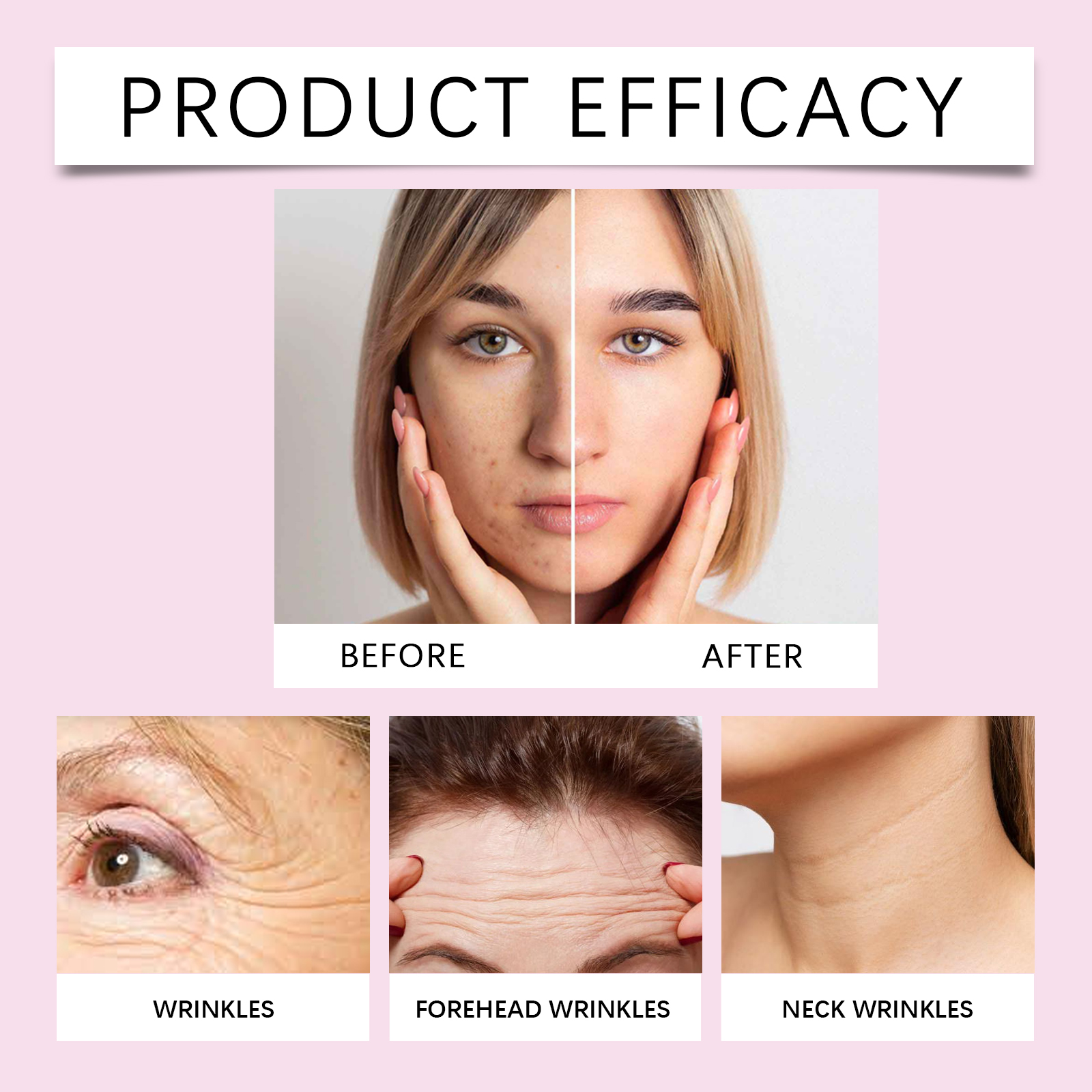 Private Label Mandelic Acid Serum Gentle Skin Exfoliator Facial Serum Silicone-Free For Women Unclogs Enlarged Pores