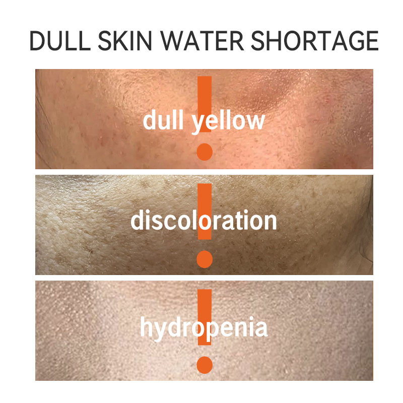 GREENLEM Vitamin C Hydrating Facial Serum With Brightening &amp; Deep Moisturizing Formula For All Skin Types Anti-Dullness