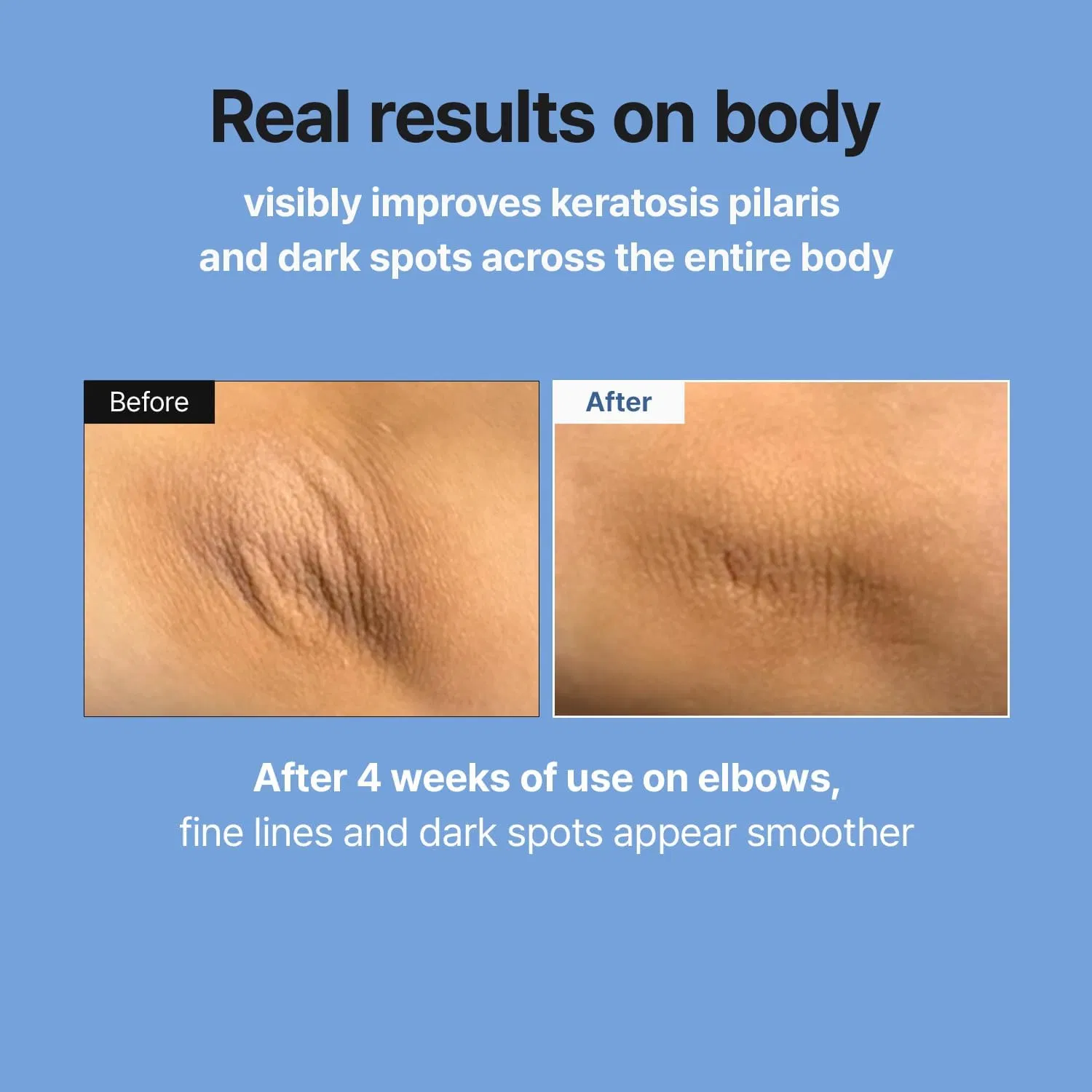 Retinal Skin Booster Serum-Beginner-Friendly, Non-Irritating Retinol for Face and Body-Pore Minimizer, Wrinkle Treatment, Glass Skin-Korean Skin Care