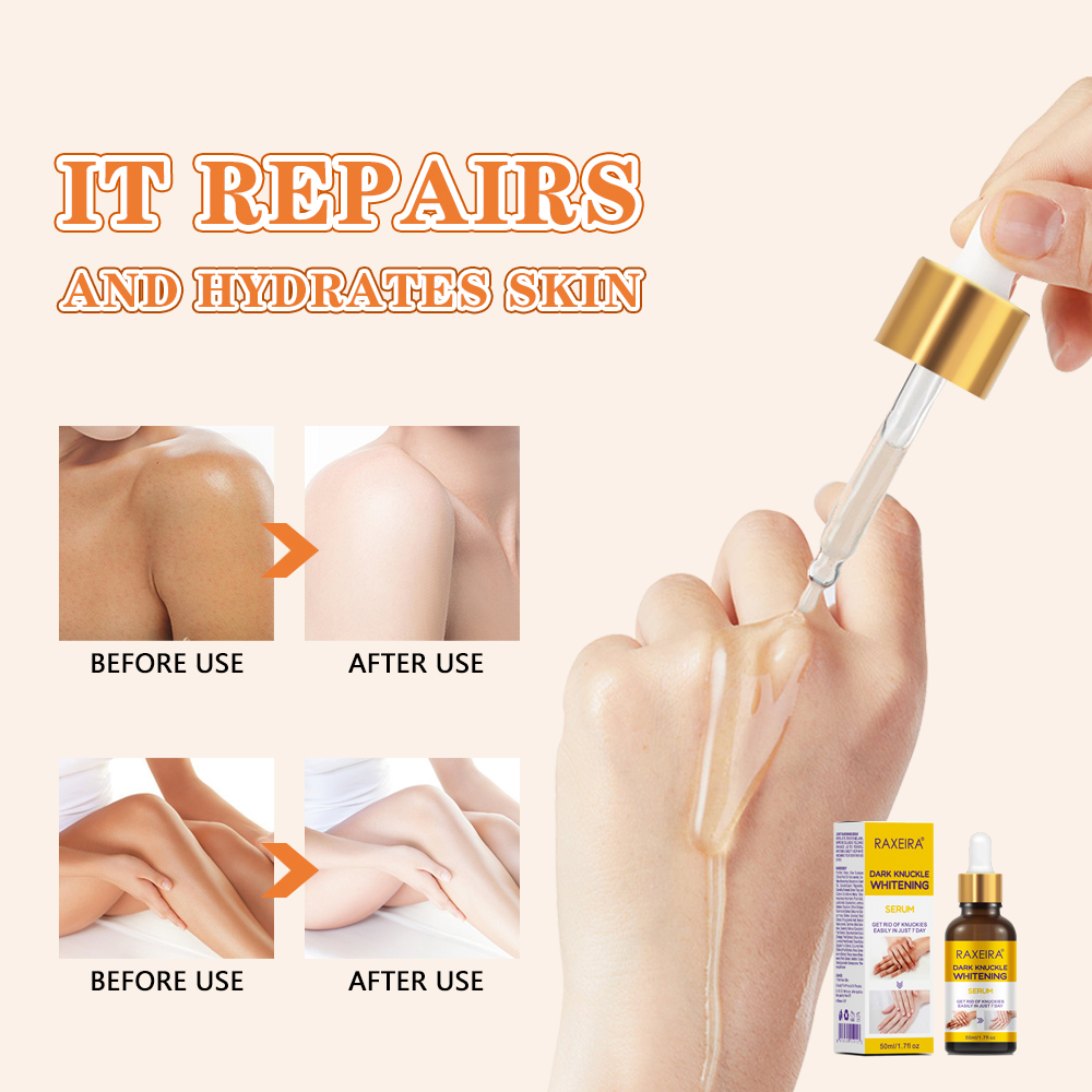 OEM/ODM Knuckles Strong Whitening Serum Removal Dark Elbow Finger Bleaching Dark Knuckles Whitening Serum for Skin Lightening
