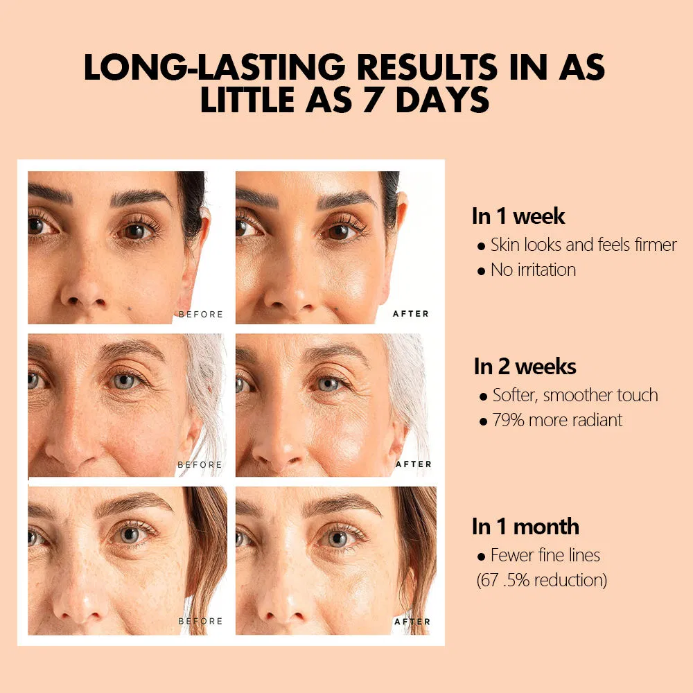 Vitamin C Retinol Hyaluronic Acid Vitamin B5 Anti-Aging Face Serum Skin Repair