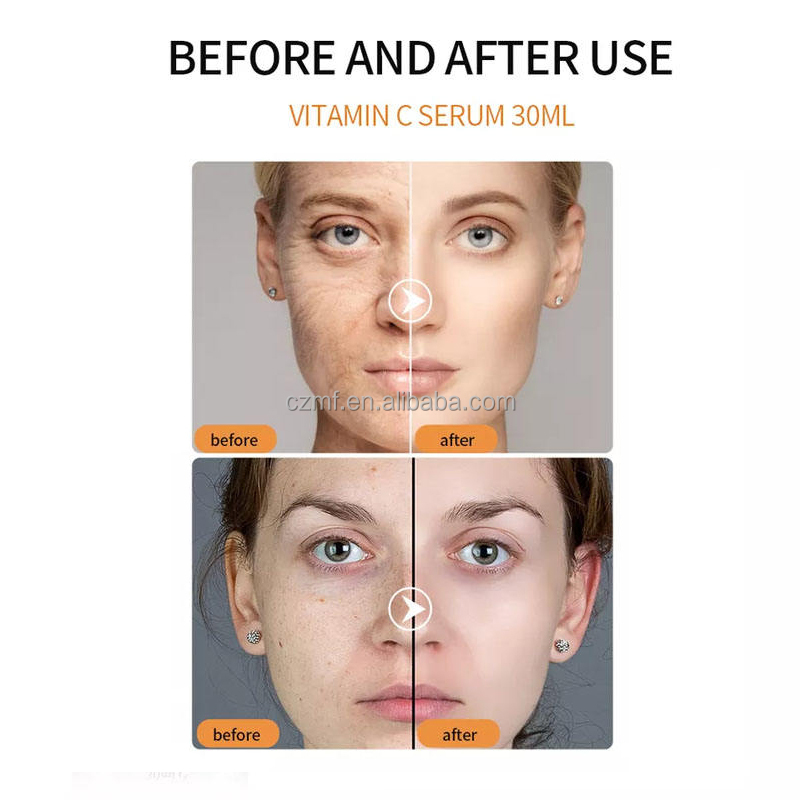 Private Label VC White Serum Anti Aging Natural Organic Whitening Brightening Anti Wrinkle With 20% Face Vitamin C Serum