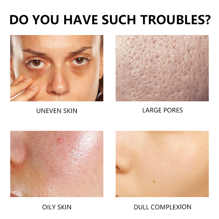 Private Label Oil Control Reduce Enlarged Pores &amp; Dark Spots Promotes Clear Skin Tone Azelaic Acid Serum