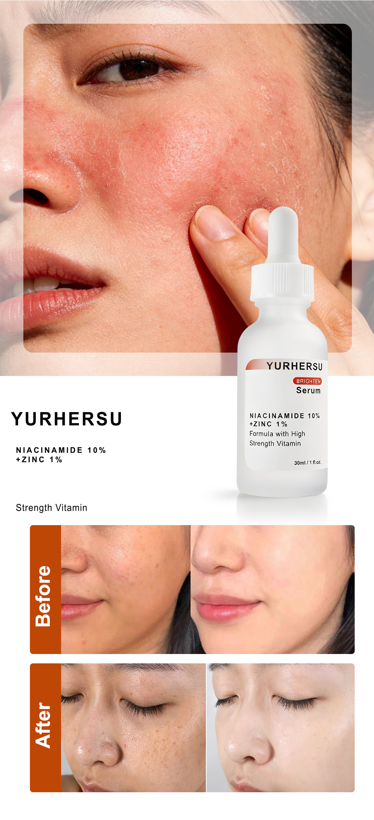 10% Niacinamide 1% Zinc PCA Serum High Concentration Vitamin B3 Facial Essence for Effective Fade Pore Minimizer Refining