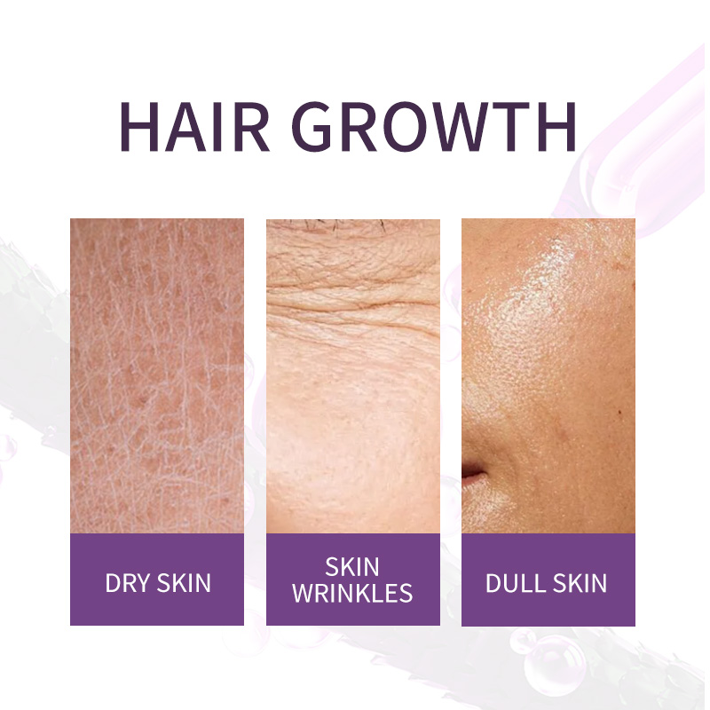Wholesale Icesea Peptide Serum, Smoothing Firming Anti-Wrinkle Serum for Facial Skin Care, Reducing Fine Lines
