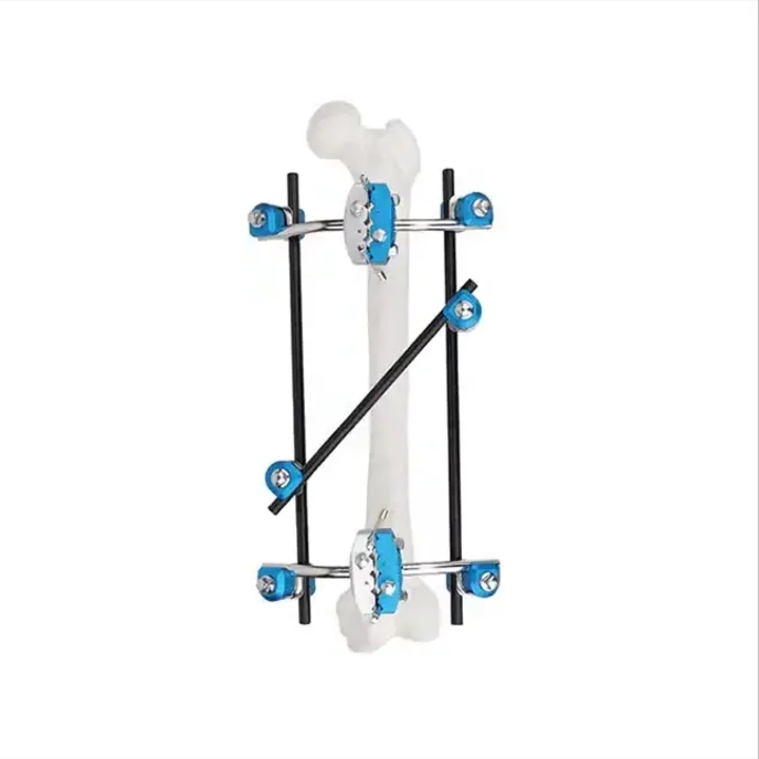 Geasure Combined External Fixator Combined Orthopedic External Fixation