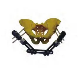 Orthopedic Mini Fixator