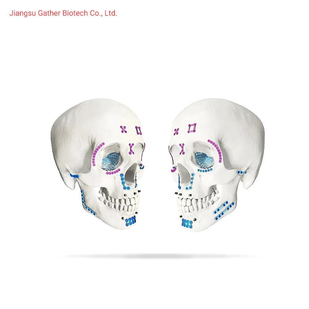 Orthopedic Surgery Implant Maxillofacial Mini Straight Plate Head Bone Plate