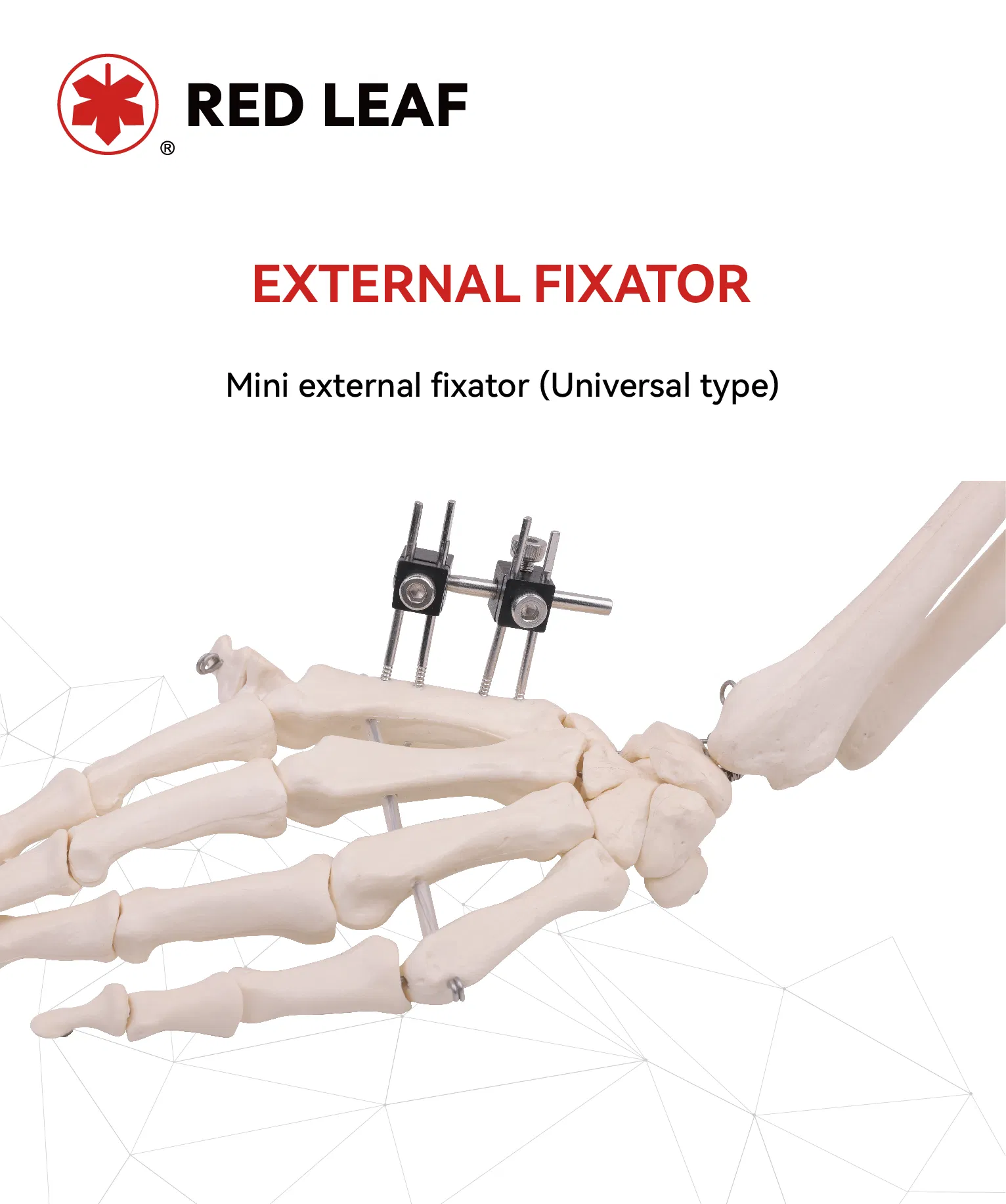External Fixation Medical Instrument