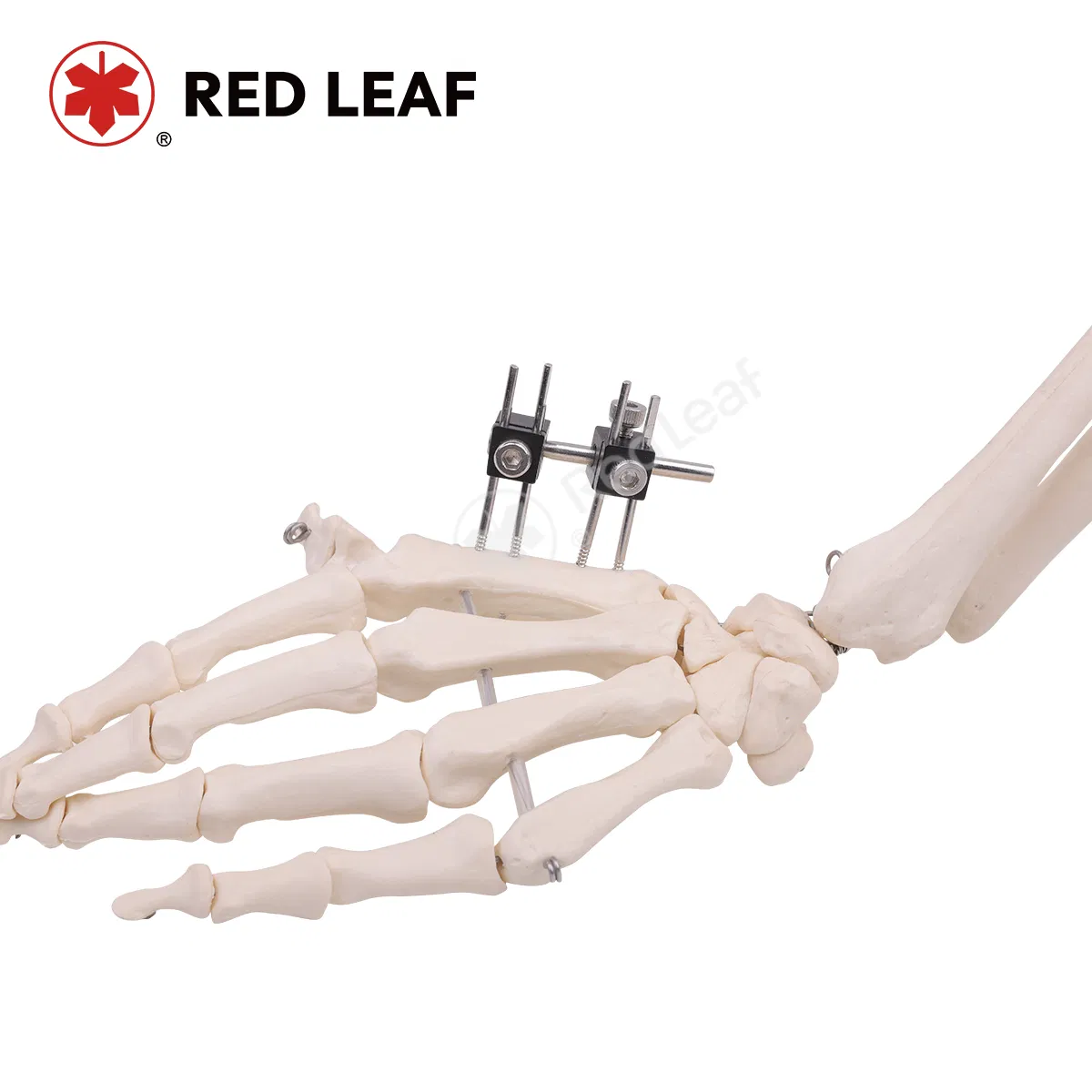 Mini Finger Universal External Fixation Medical Instrument Orthopedic Fracture Fixator