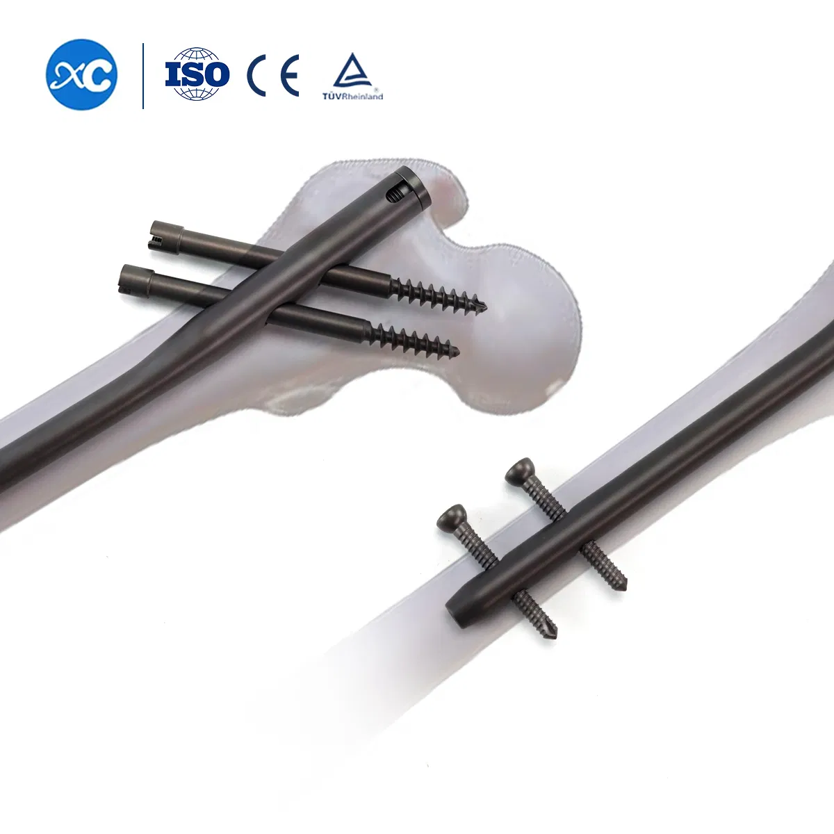 Orthopedic Implants Intramedullary Nailing Pfna Gamma Intramedullary Nail