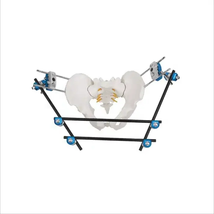 Geasure Combined External Fixator Combined Orthopedic External Fixation