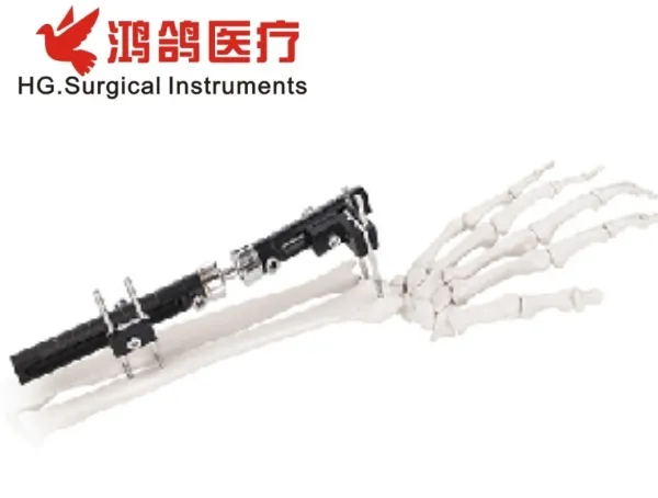 Orthopedic External Fixator 2