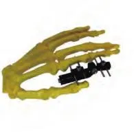 Mini Fixator Component